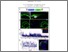[thumbnail of MacDonald_A Novel Tool to Measure Extracellular Glutamate in the Zebrafish Nervous System In Vivo_VoR.pdf]