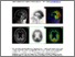 [thumbnail of Chan_PET-MRI EJNM submission FINAL.pdf]
