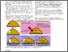 [thumbnail of ELIOT is very different from TARGIT-IORT during lumpectomy for breast cancer - final version.pdf]