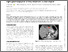 [thumbnail of Gastric conduit reconstruction after esophagectomy with right gastroepiploic artery absence a case report.pdf]