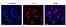 [thumbnail of Additional file 1: Colocalisation of ATF-3 and Fluorogold in damaged neurons of adult DRGs.]