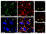 [thumbnail of Additional file 4: Macrophage ring formation around adult DRGs neurons 7 days after nerve injury.]