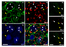 [thumbnail of Additional file 5: Satellite cells and macrophage staining in adult DRGs]