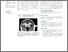 [thumbnail of Neurology-2016-Marshall-e283.pdf]