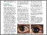 [thumbnail of Sagoo_squamous-cell-carcinoma-of-the-conjunctiva-2.pdf]
