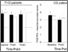 [thumbnail of Rocchi_7_Bologna et al., 2016_Cerebellar cTBS dystonia_CLINPH_Figure 2_CS 300 dpi R1.jpg]